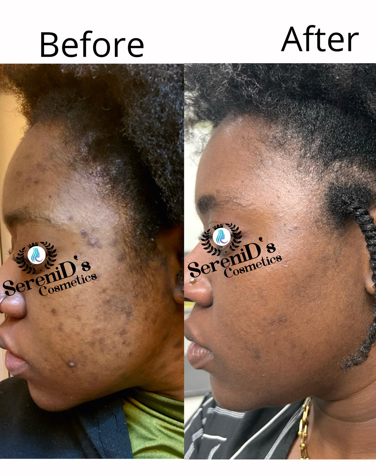 Wholesale Turmeric Bar soap / Kurkuma-Seife